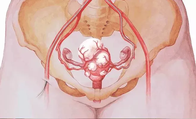 महिला जननांग में घात यानि चोट कितनी खतरनाक