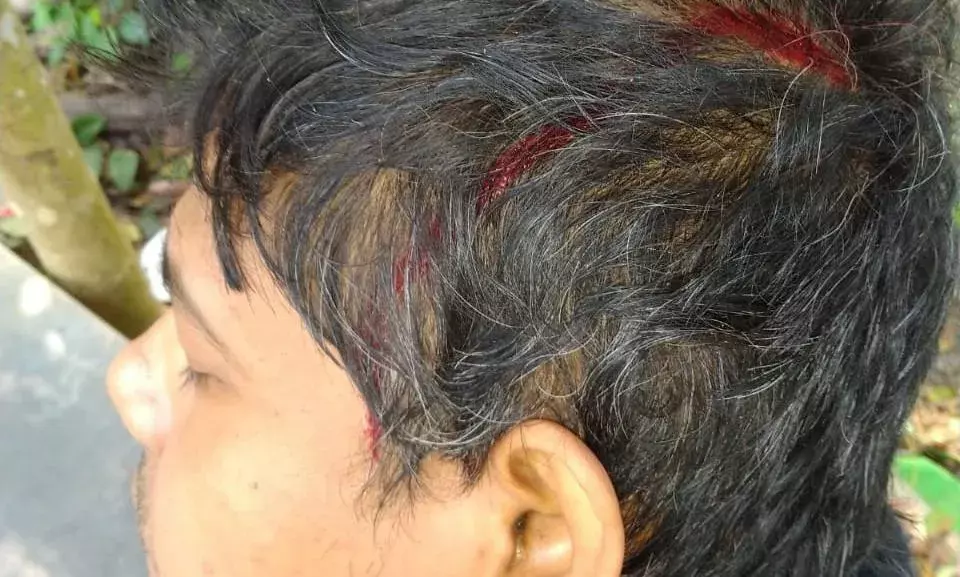 बंगाल में अखिल भारतीय विद्यार्थी परिषद् के कार्यकर्ताओ पर टीएमसी का हमला बंगाल में अखिल भारतीय विद्यार्थी परिषद् के कार्यकर्ताओ पर टीएमसी का हमला