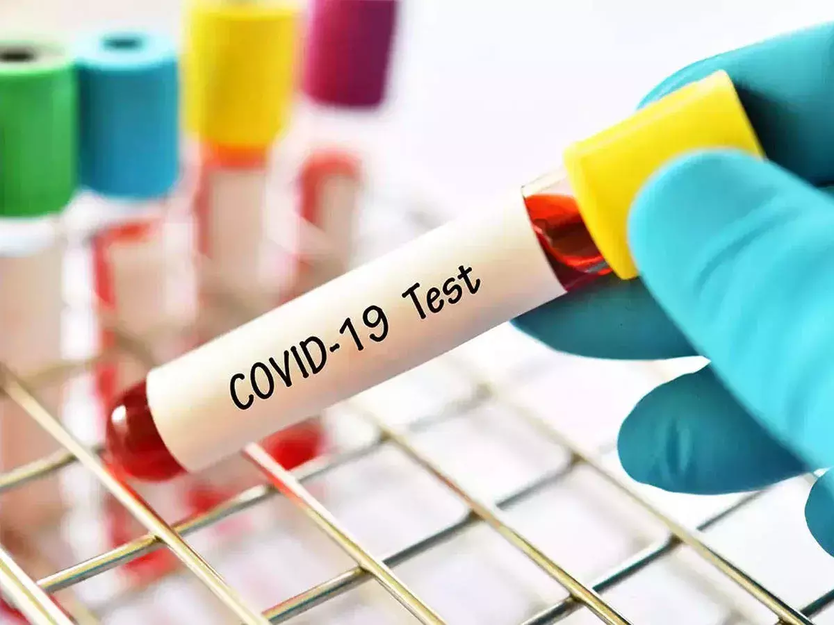 आरटी पीसीआर रिपोर्ट में नेगेटिव आने के बाद यदि सिटी स्कैन में मिलता है वायरस तो क्या करें.