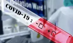 рдЙрддреНрддрд░ рдкреНрд░рджреЗрд╢ рдореЗрдВ рд░рд╡рд┐рд╡рд╛рд░ рдХреЛ рдХреЛрд░реЛрдирд╛ рдХреЗ 30,596 рдирдпреЗ рдорд╛рдорд▓реЗ рдЖрдП рд╕рд╛рдордиреЗ.... рдЙрддреНрддрд░ рдкреНрд░рджреЗрд╢ рдореЗрдВ рд░рд╡рд┐рд╡рд╛рд░ рдХреЛ рдХреЛрд░реЛрдирд╛ рдХреЗ 30,596 рдирдпреЗ рдорд╛рдорд▓реЗ рдЖрдП рд╕рд╛рдордиреЗ....