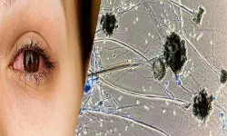 जम्मू-कश्मीर में भी पंहुचा ब्लैक फंगस, हुई पहली मौत....