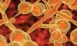 कोरोना महामारी के बीच अमेरिका में नए फंगल की दस्तक, जाने इसके बारे में