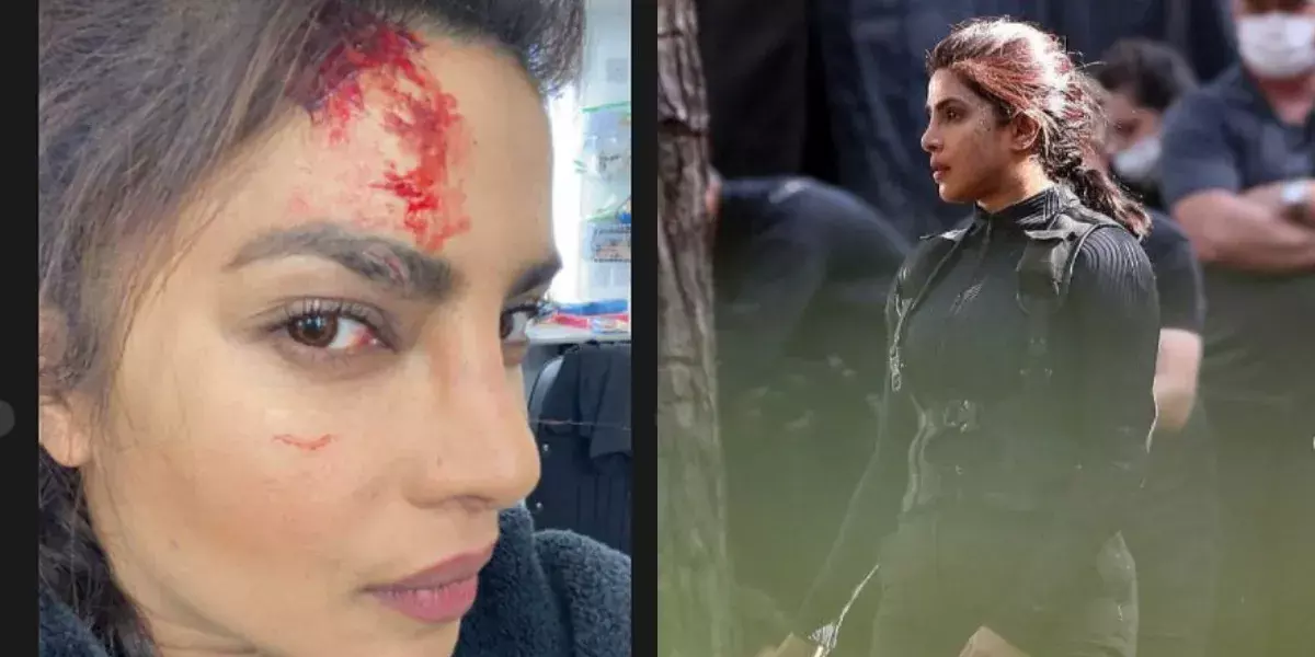 рджреЗрд╕реА рдЧрд░реНрд▓ рдкреНрд░рд┐рдпрдВрдХрд╛ рдЪреЛрдкрдбрд╝рд╛ рдХреЛ рд▓рдЧреА рд╢реВрдЯрд┐рдВрдЧ рдХреЗ рджреМрд░рд╛рди рдЪреЛрдЯ, рд╢реЗрдпрд░ рдХреА рддрд╕реНрд╡реАрд░реЗ рджреЗрд╕реА рдЧрд░реНрд▓ рдкреНрд░рд┐рдпрдВрдХрд╛ рдЪреЛрдкрдбрд╝рд╛ рдХреЛ рд▓рдЧреА рд╢реВрдЯрд┐рдВрдЧ рдХреЗ рджреМрд░рд╛рди рдЪреЛрдЯ, рд╢реЗрдпрд░ рдХреА рддрд╕реНрд╡реАрд░реЗ