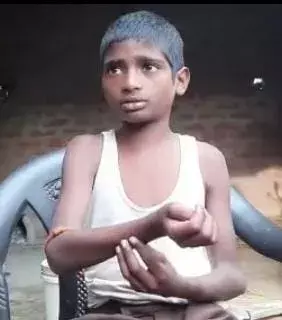 टीचर ने मासूम को बेरहमी से पीटा टीचर ने मासूम को बेरहमी से पीटा