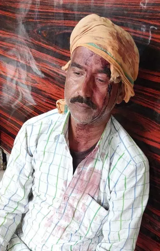 рджрдмрдВрдЧреЛ рдиреЗ рд╕рдЧреЗ рднрд╛рдИрдпреЛрдВ рдХреА рдкрд┐рдЯрд╛рдИ рдХрд░ рдлреЛрдбрд╝рд╛ рд╕рд┐рд░ рджрдмрдВрдЧреЛ рдиреЗ рд╕рдЧреЗ рднрд╛рдИрдпреЛрдВ рдХреА рдкрд┐рдЯрд╛рдИ рдХрд░ рдлреЛрдбрд╝рд╛ рд╕рд┐рд░