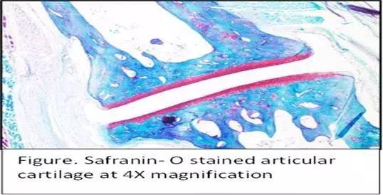 Newly synthesised biocompatible drug delivery system combined with anti-inflammatory drugs brings potential solution for rheumatoid arthritis