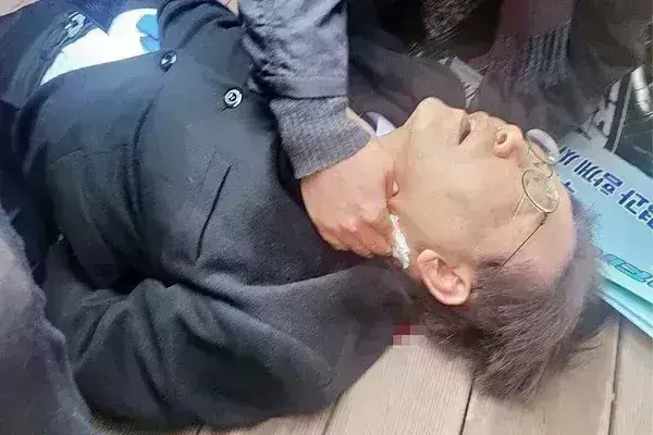 दक्षिण कोरिया के विपक्षी नेता ली जे-म्युंग की गर्दन पर चाकू से हमला, हालत गंभीर