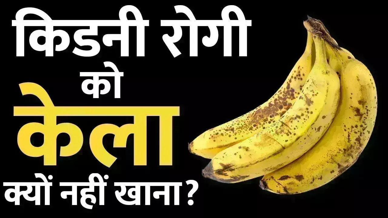 किडनी वाले मरीज को नहीं खाना चाहिए केला, जानिए हेल्थ एक्सपर्ट क्यों करते हैं मना?