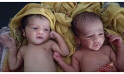 अस्पताल में जुड़वा बच्चों का जन्म, माता-पिता ने नाम रखा कोविड और कोरोना