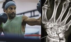 फिल्म तूफान की शूटिंग के दौरान फरहान के हाथ में हुआ फ्रैक्चर ...