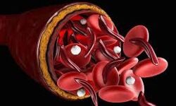 Plasma therapy will be started to treat covid-19 patients: West Bengal