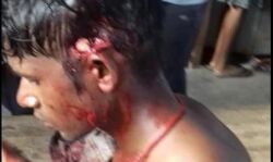 तेंदुए के हमले से किशोर घायल