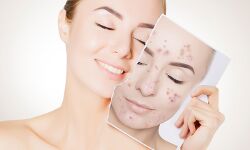 स्किन फास्टिंग : क्या है ? एक्सपर्ट्स इस पर क्या कहते हैं!